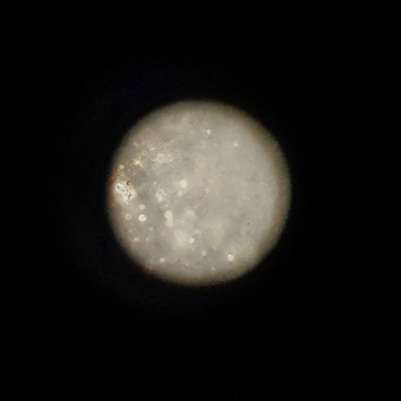 The Moon over Sunbury, Australia — full moon, Lunar Day 17
